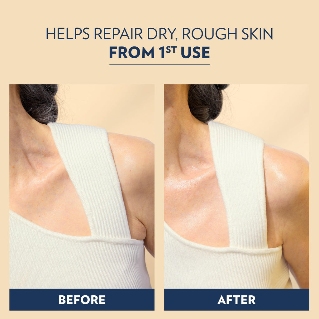 Vaseline Advanced Repair Body Lotion Advanced Repair Unscented for Dry Skin Lotion Made with Ultra-Hydrating Lipids and Vaseline Jelly That Repairs Extremely Dry Skin 20.3 Fl oz