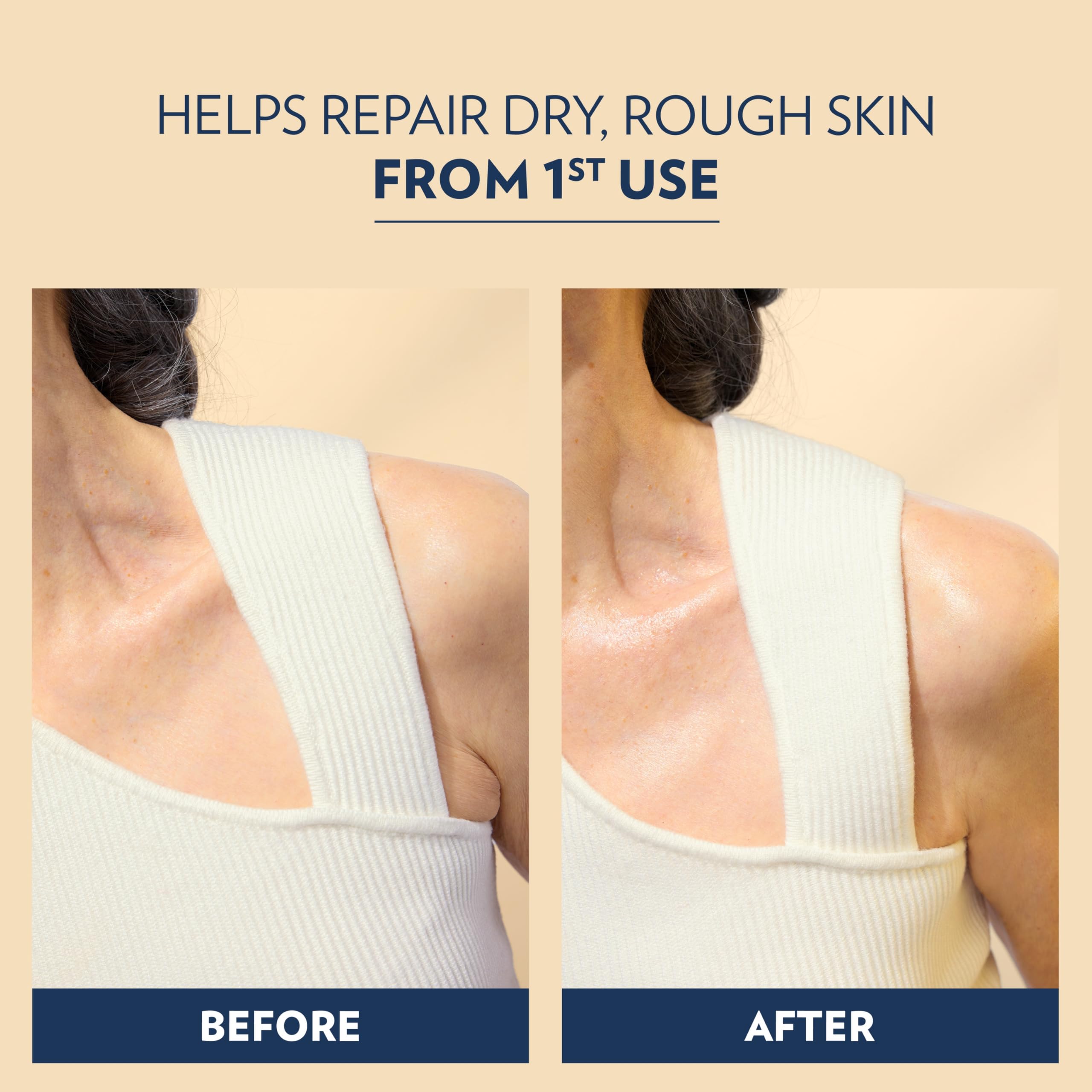Vaseline Advanced Repair Body Lotion Advanced Repair Unscented for Dry Skin Lotion Made with Ultra-Hydrating Lipids and Vaseline Jelly That Repairs Extremely Dry Skin 20.3 Fl oz